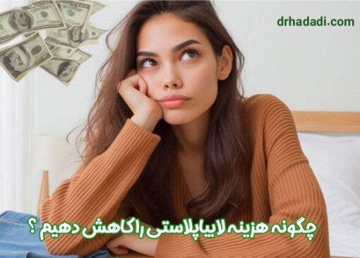 لابیاپلاستی